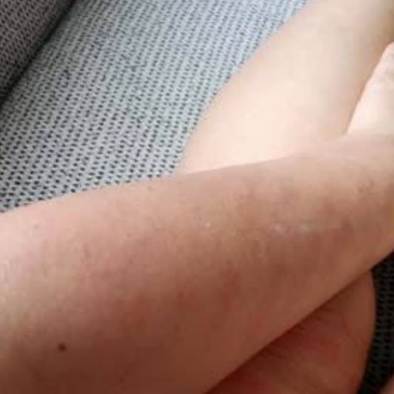 Like Me Beauty Center - Melike Akkoca Güzellik Merkezi Kalitesiz Hizmet