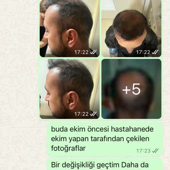 Medical Park Hastanesi Personel Tavrı Konuşması