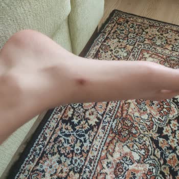 Ceyo Terlik Kızımın Ayağını Yara Yaptı