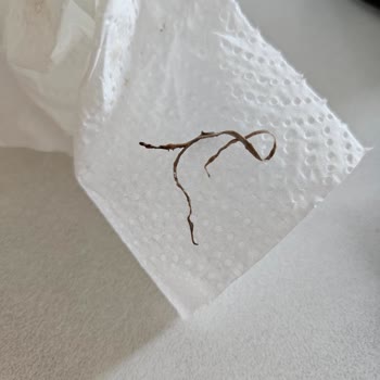 Eti Gıda Market Alışverişinde Çikolatadan Çıkan Bilinmeyen Cisim Şoku!