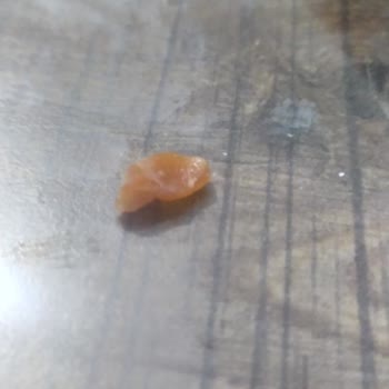 My Külah Üründen Taş Çıktı