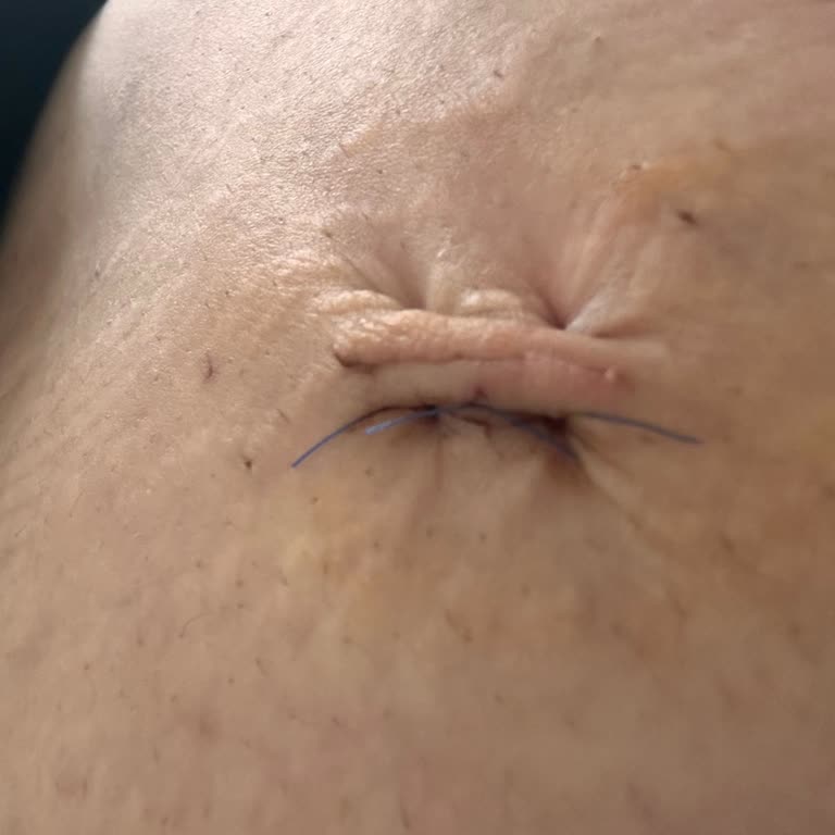 Sancaktepe Şehit Prof. Dr. İlhan Varank Eğitim Araştırma Hastanesi Devlet Hastanesi Cerrahi Deneyimi