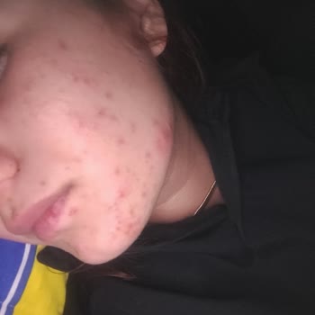 Nivea Markası Kaldırılmasına Rica Ediyorum