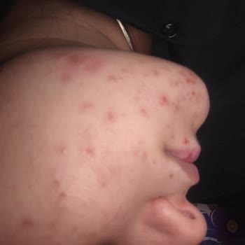 Nivea Markası Kaldırılmasına Rica Ediyorum