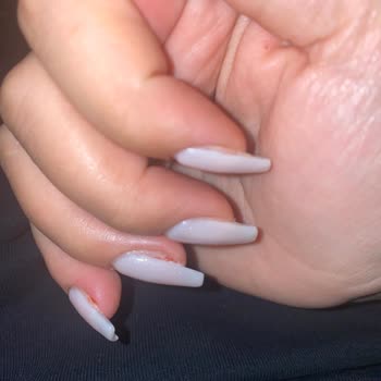 Başkent Kuaför Protez Tırnak Yaptırdım Çok Kötü Hale Geldi Tırnaklarım Sızlıyor Yara