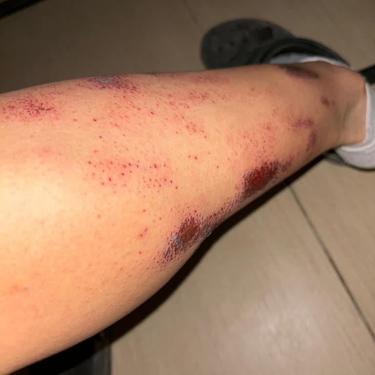 Veet Tüy Dökücü Krem Bacak Tahrişi