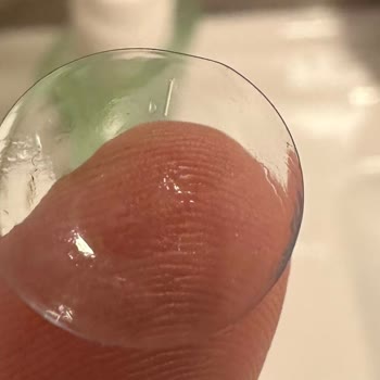 My Acuvue Oasys Lenses Arrived Warped and Scratched