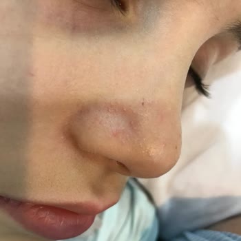 Sebamed Güneş Kremi Hk