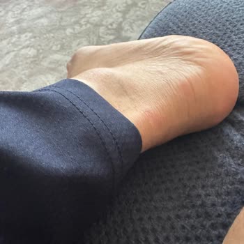 Skechers Da Büyük Hayal Kırıklığı Yaşadım