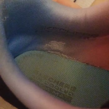 Skechers Spor Ayakkabıda Kalite Sorunu Ve Garanti Süreci