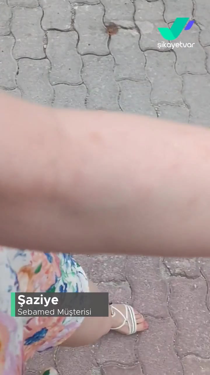 Sebamed Güneş Losyon Alerji Yaptı! videonun kapak resmi