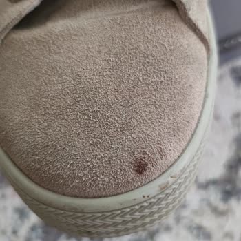 Deichmann 20 Günlük Ayakkabıda Lekelenme Sıkıntısı