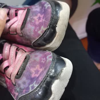 Skechers Ürünlerin Arkasında Durmuyor
