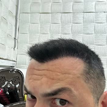 İstanbul Hairline Sac Ekim Memnuniyetsizliği