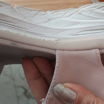 Skechers Boyner'den Aldığım Sandaletin Kalitesizliği