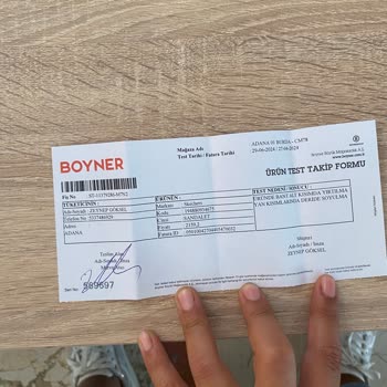 Skechers Boyner'den Aldığım Sandaletin Kalitesizliği
