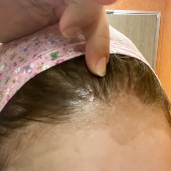 Palette Palet Saç Açıcı Derim Yandı