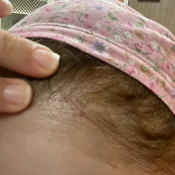 Palette Palet Saç Açıcı Derim Yandı