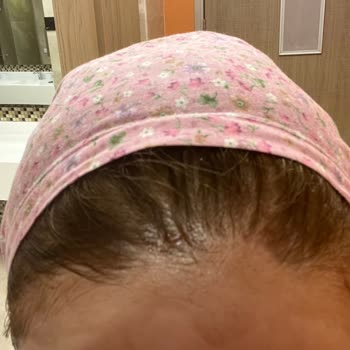 Palette Palet Saç Açıcı Derim Yandı