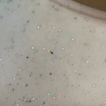 Advance Türkiye Advence Mamalardan Böcekler Çıkıyor