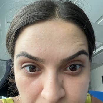 Estpoint 1AYDA Sönen Botoks