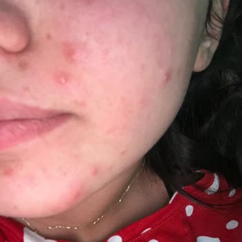 Sinoz Pembe Güneş Kremi