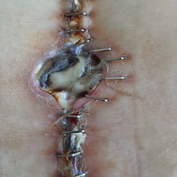 Op. Dr. Vasfi Çelik Doktorların İhmalkar Davranışları Ve Sonuçları