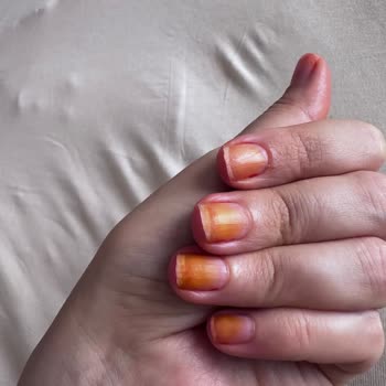 Pastel Kozmetik Pastel 261 No Oje Tırnaklarımı Turuncu Yaptı