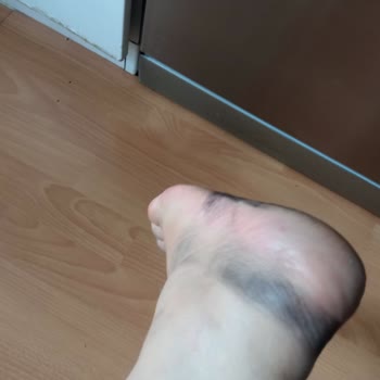 Etichet Kalitesiz Ayıplı Ürün