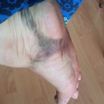 Etichet Kalitesiz Ayıplı Ürün