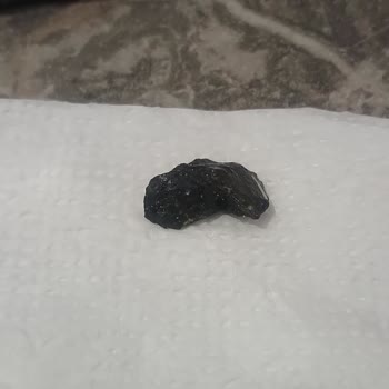 Amigo Kuruyemiş İçinde Taş Çıktı