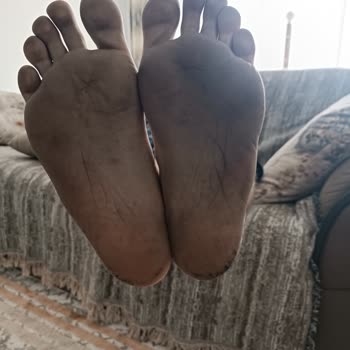 Deichmann Björndal Sandalet Mağduriyeti