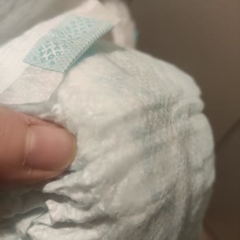 Prima Bezin İçindeki Sert Cisim