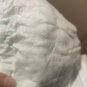 Prima Bezin İçindeki Sert Cisim