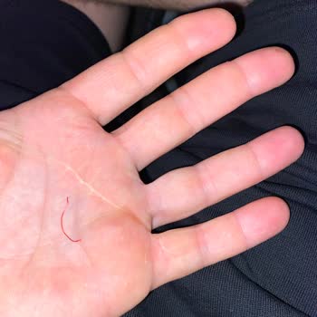 Aysultan Şekerleme Ağzıma Attığım Şekerden Ne Olduğu Belli Olmayan Bir Plastik Çıktı