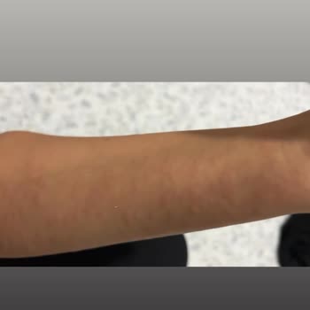 Bingo Sıvı Deterjan Alerjik