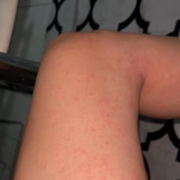 Bingo Sıvı Deterjan Alerjik