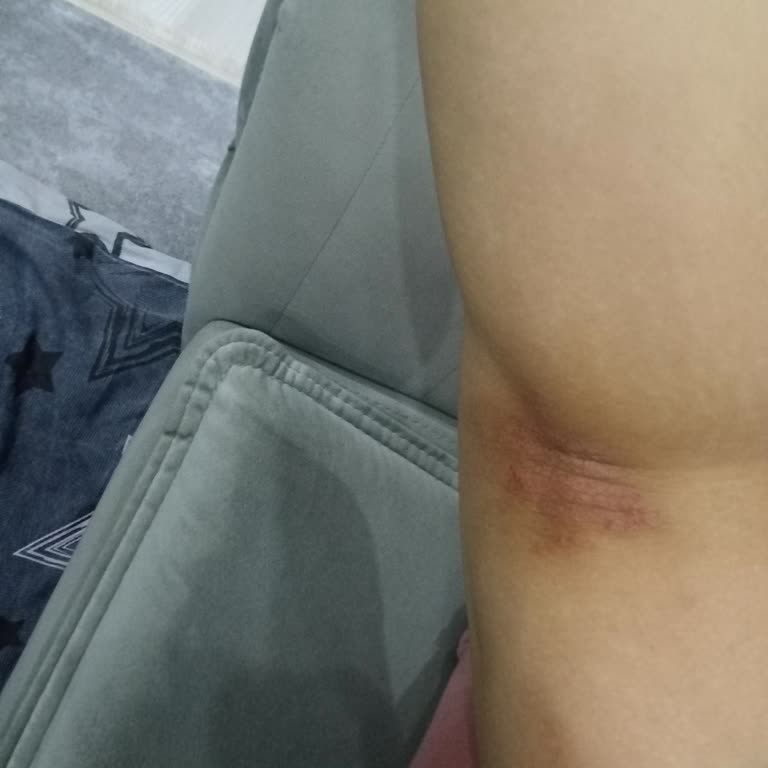 BlueMoon Estetik & Güzellik Merkezi Denizli Blumun Güzellik Merkezi