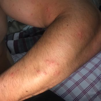 Veet Gerekli Mercilere Şikayette Bulunacağım