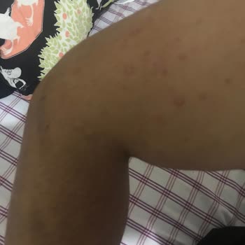 Veet Gerekli Mercilere Şikayette Bulunacağım