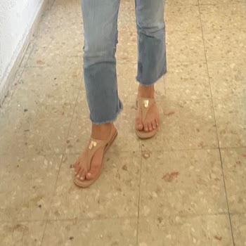 Nine West Sandalet Ayağımı Vurdu İletişime Geçtim Dönüş Yok