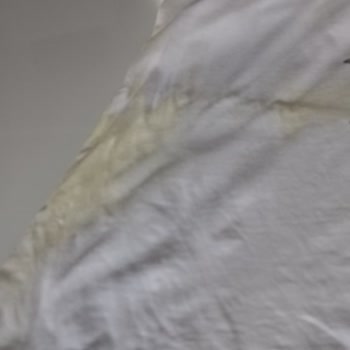 The Pink Stuff Leke Çıkarıcı Sarı Leke Bıraktı.