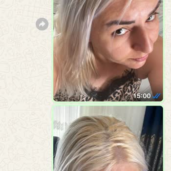 Gaziantep Kuaförler Odası Kuaför Yaptığı Hata