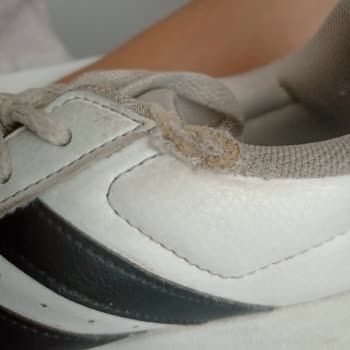 Adidas Spor Ayakkabı 2 Ayda Yırtıldı