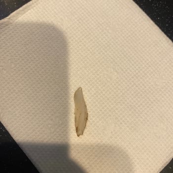 Sbarro Yemekten Plastik Çıktı