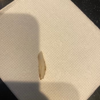 Usta Pideci Yemekten Plastik Çıktı