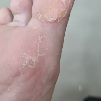 Birkenstock Marka İçin Verilen Paraya Yazık
