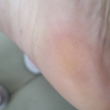 Birkenstock Marka İçin Verilen Paraya Yazık