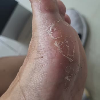 Birkenstock Marka İçin Verilen Paraya Yazık