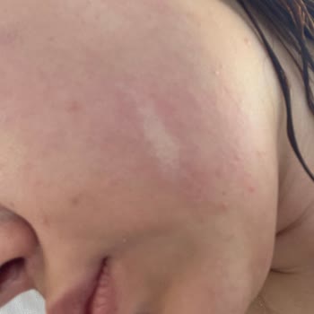 Agiva Renk Açıcı Sprey Vücudumda Reaksiyona Sebep Oldu